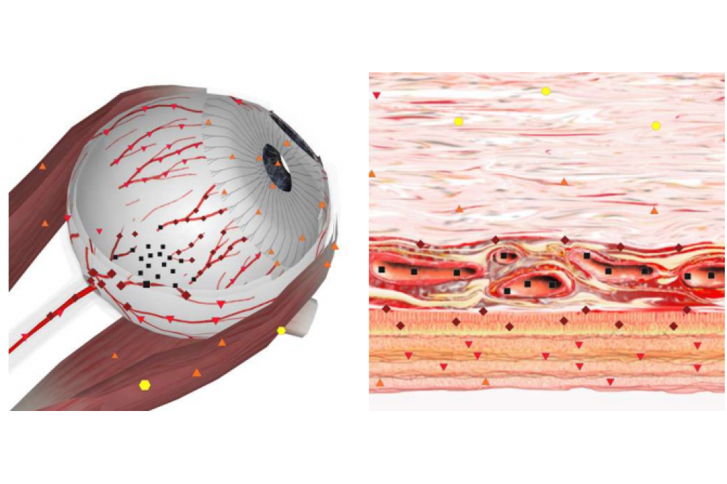 Combined NLS study of space-occupying lesions of ocular organs