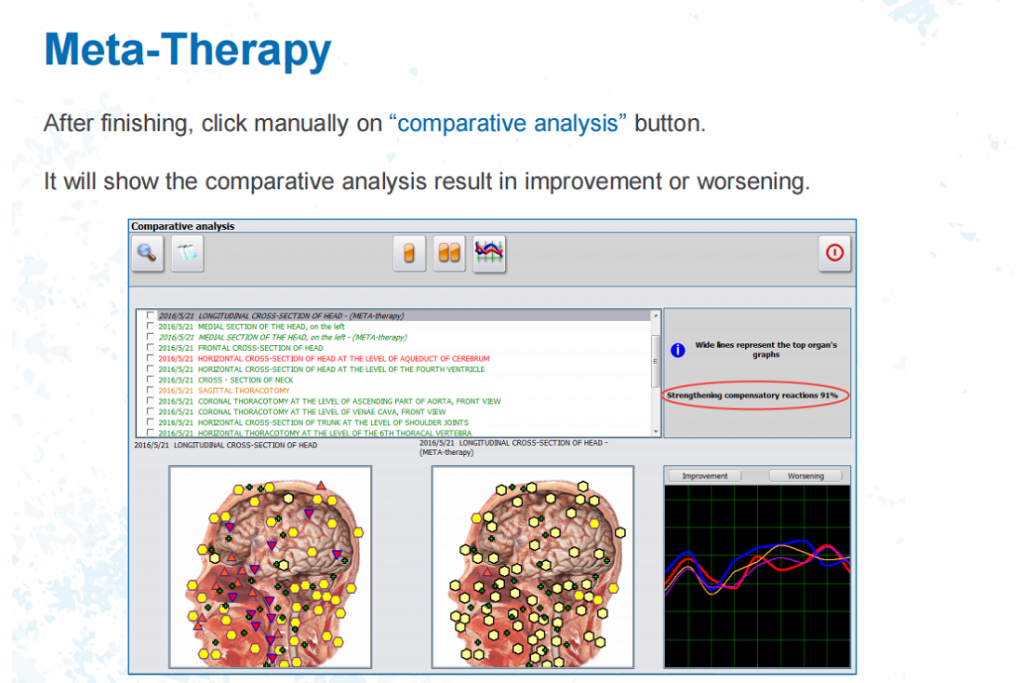 The Meta Therapy Of Bioresonance NLS Device